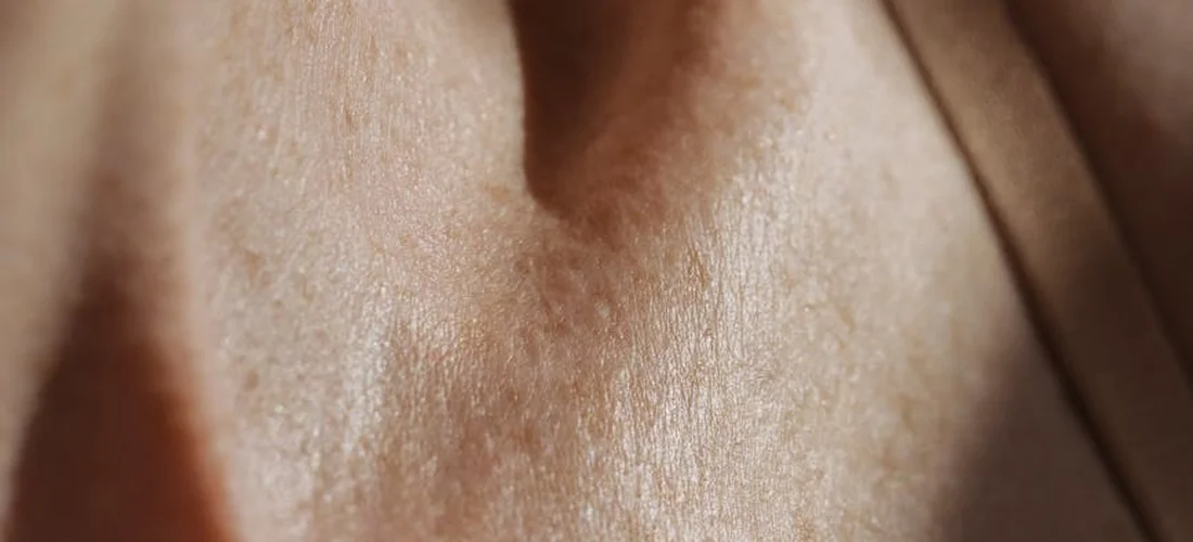 Close-up view of skin texture and color